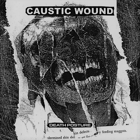 Caustic Wound – Death Posture (2020)