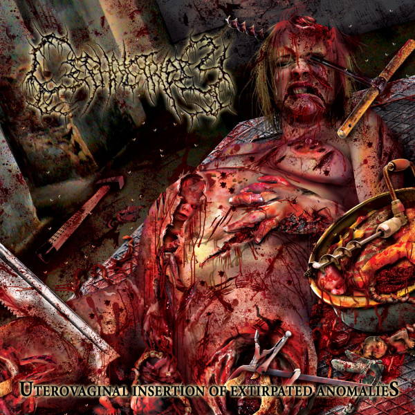 Cephalotripsy – Uterovaginal Insertion Of Extirpated Anomalies (2007)