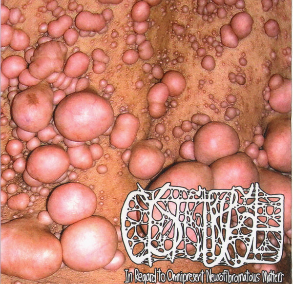 Cystgurgle – In Regard to Omnipresent Neurofibromatous Matters (2014)