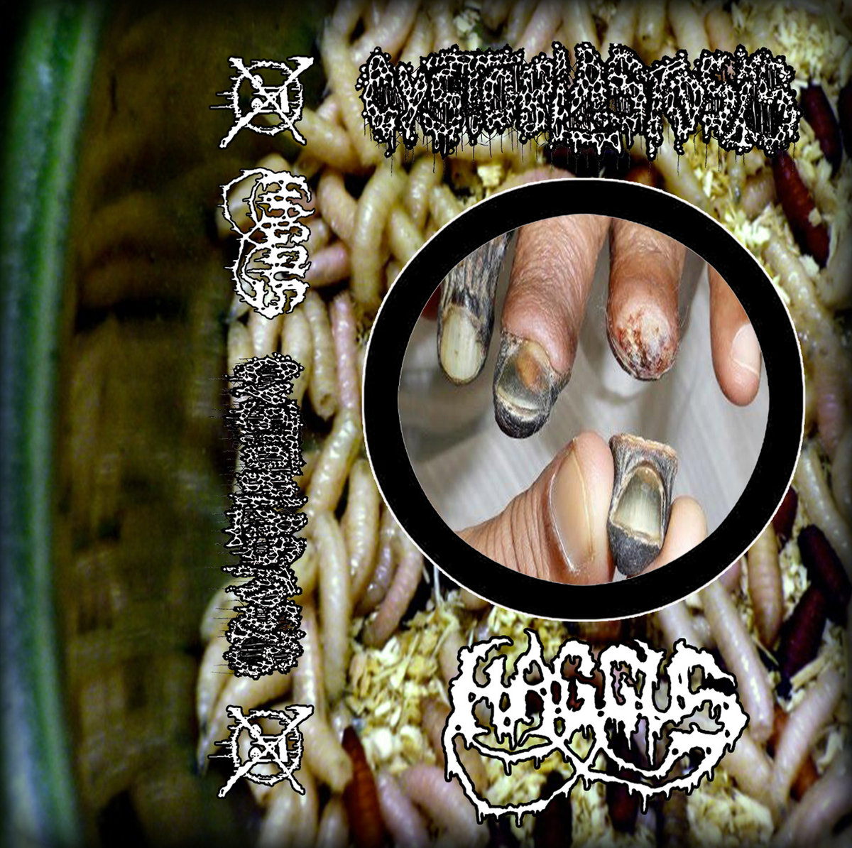 Haggus / Cystoblastosis – Split Tape (2017)