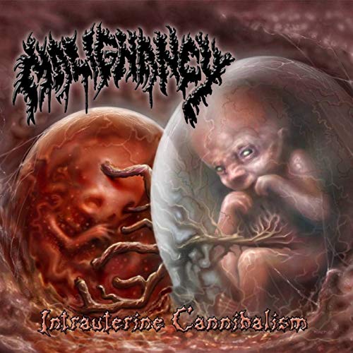 Malignancy – Intrauterine Cannibalism (1999)