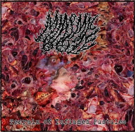 Miasmic Ooze – Terrain Of Inflamed Pustules (2021)