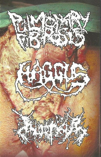 Pulmonary Fibrosis / Haggus / Inopexia – Split Tape (2017)